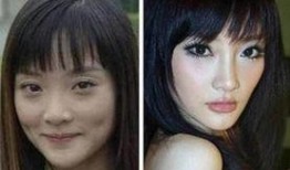 明星做隆鼻,揭秘隆鼻术的神奇魔力