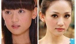 明星做隆鼻,揭秘隆鼻术的神奇魔力